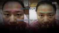 朵妍清祖?zhèn)髦兴幟婺?祛斑價(jià)格西紅柿祛斑的小竅門(mén)面部黃褐斑
